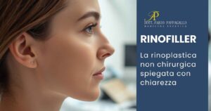 Consulenza per filler naso e rinoplastica non chirurgica con medico estetico a Molfetta rinoplastica non chirurgica filler naso